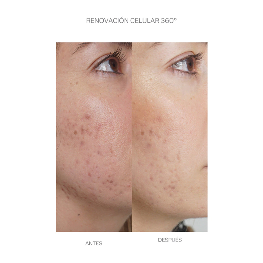 Bek Brightera Corrective Peeling Toner Facial