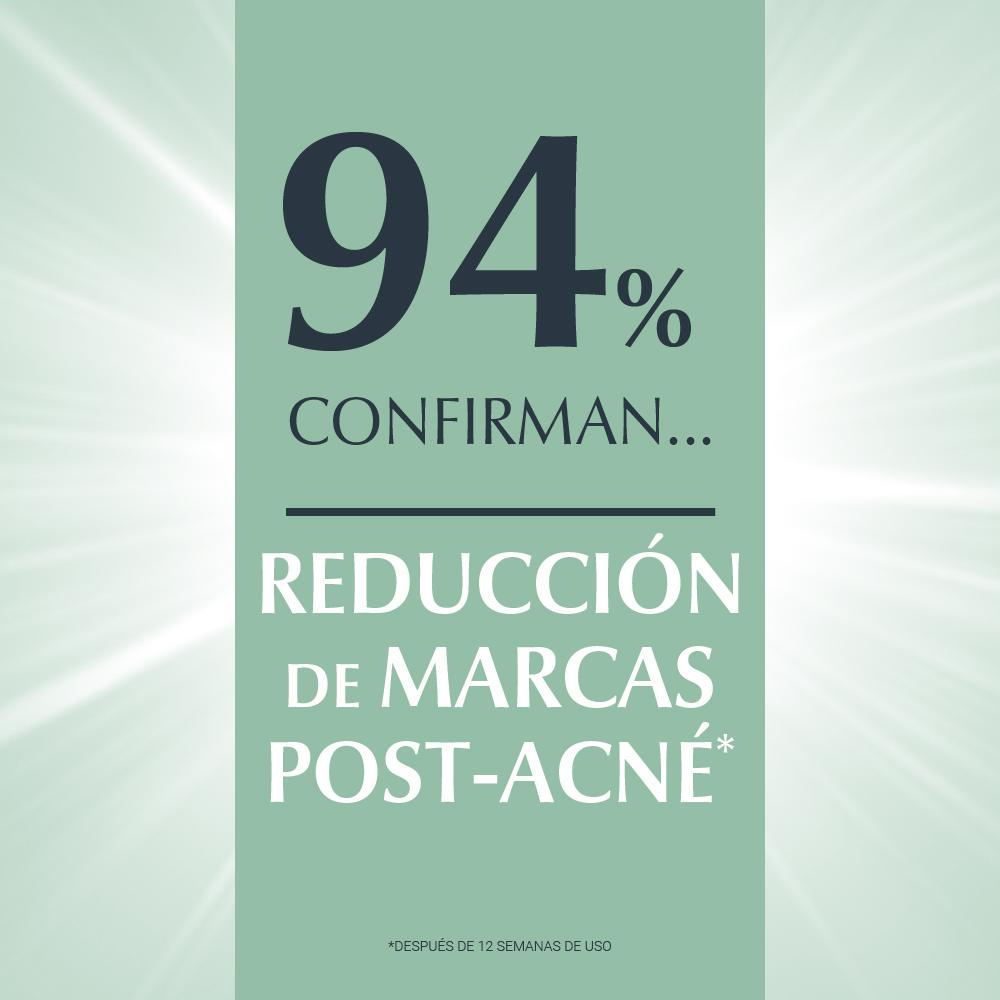 Eucerin Dermopure Oil Control Serum Triple Efecto