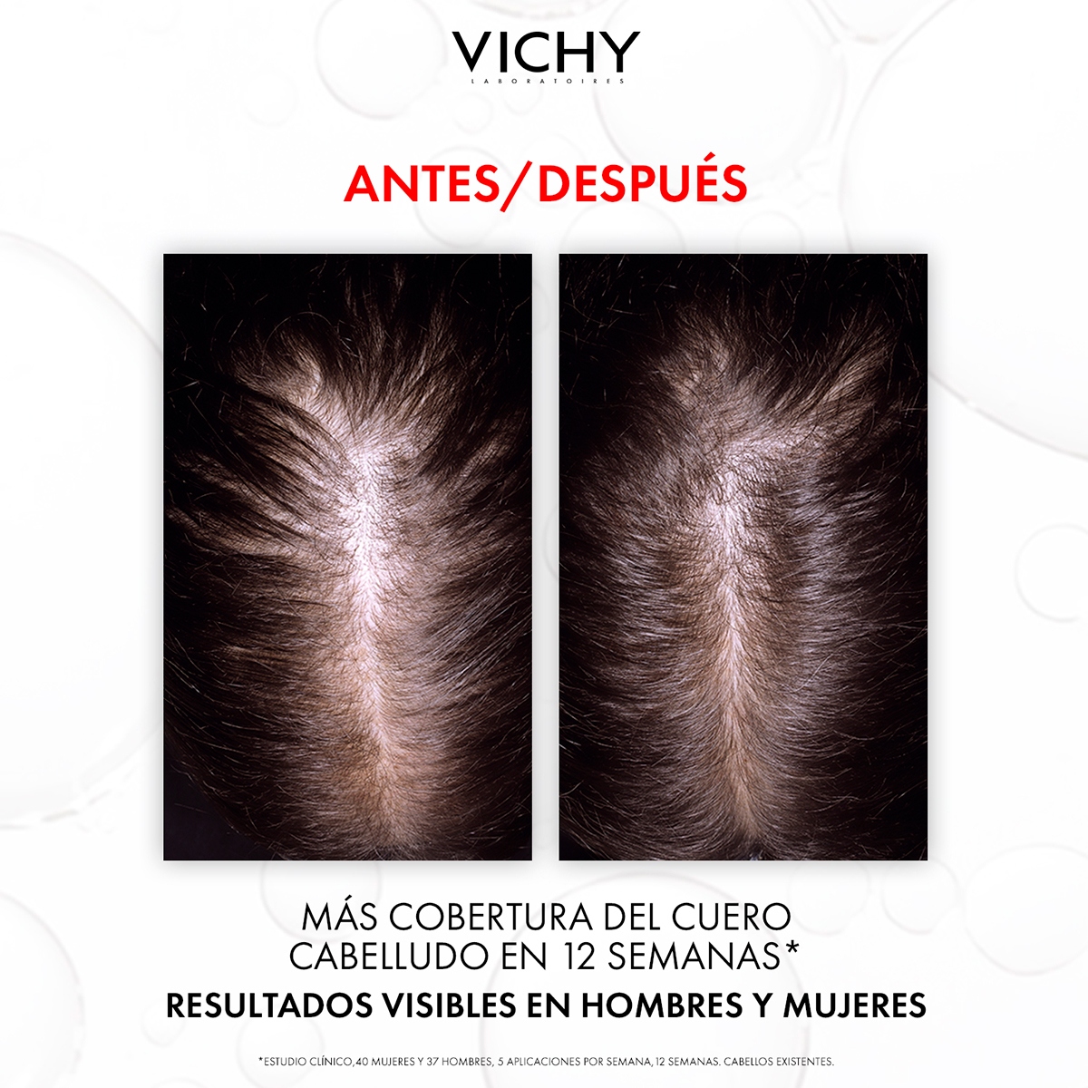 Vichy Dercos Aminexil Clinical R.e.g.e.n Serum