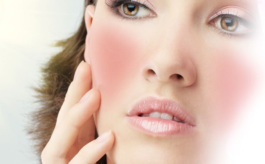 Cuidados y maquillaje para piel con rosácea